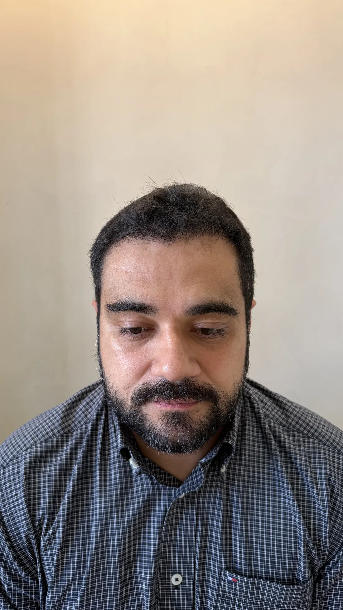 Antes, caso educativo de linha frontal