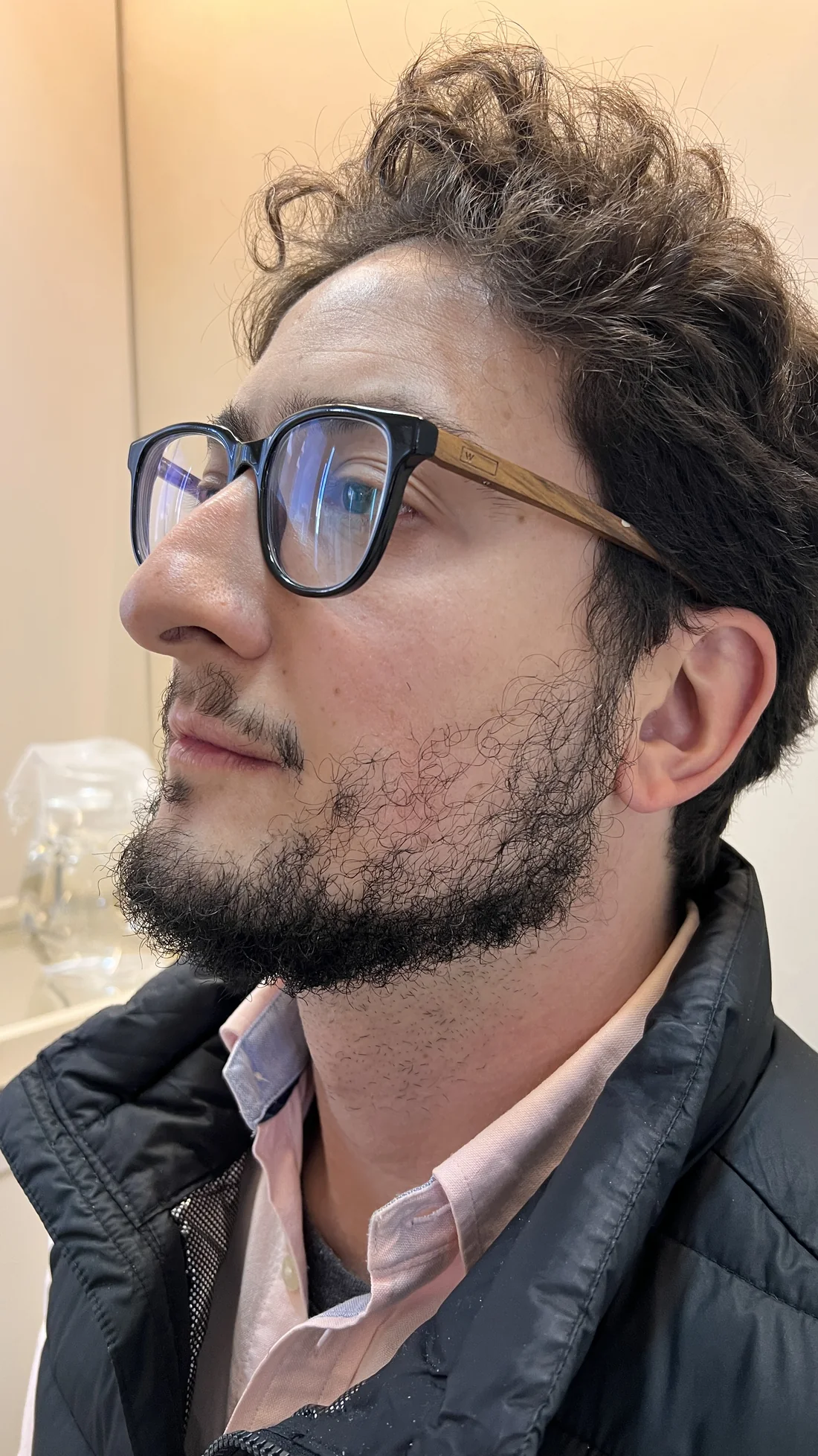 Antes, caso educativo de barba